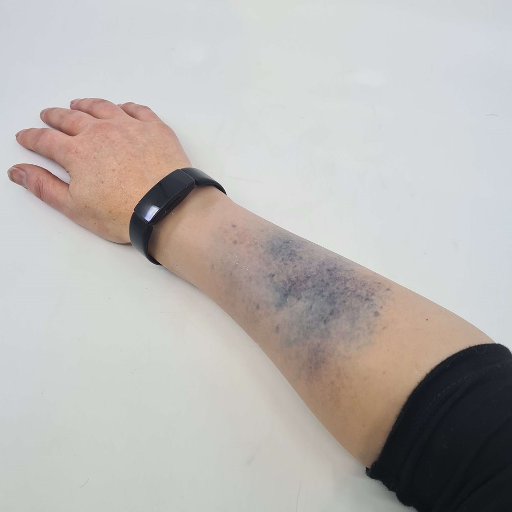M07 – MedicFX – Bruise Sleeve