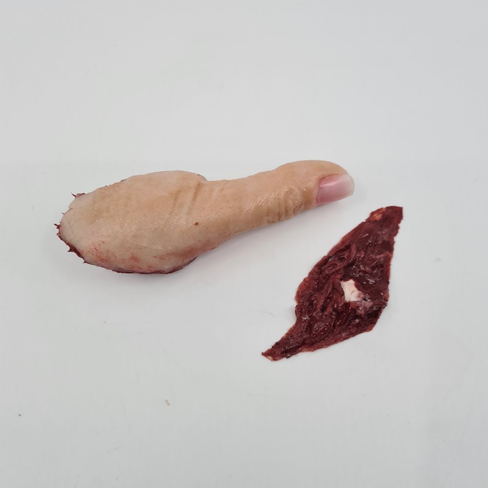 M24 – MedicFX – Severed Male Thumb With Wound