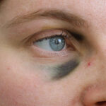TC-Black-Eyes-C
