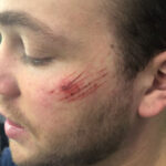 TC-Random-Wounds 1