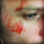 TC-Skin-Scrapes 1