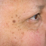 TC-Age-Marks