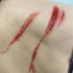 TC-Whip-Marks 1